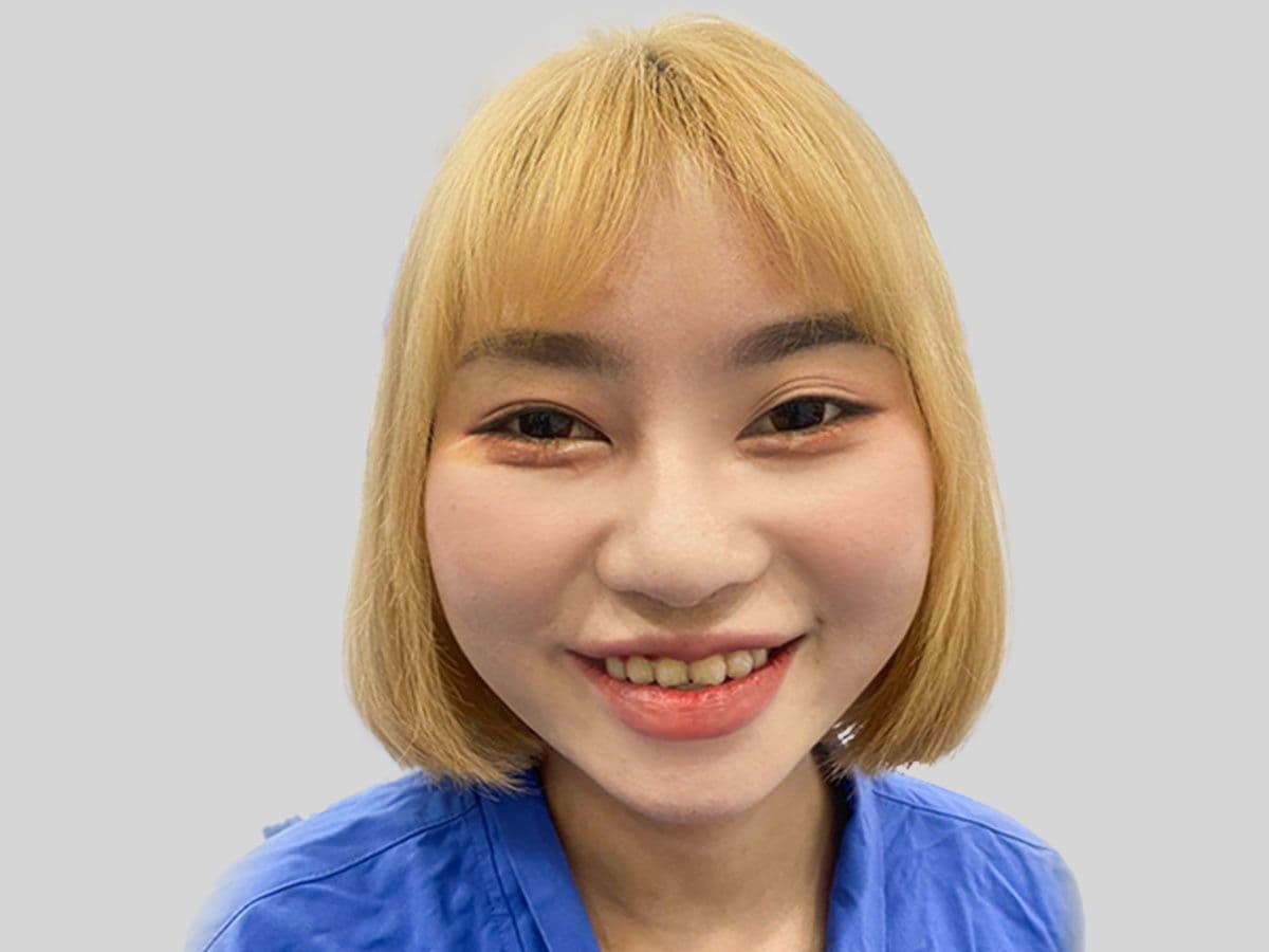 - Before
